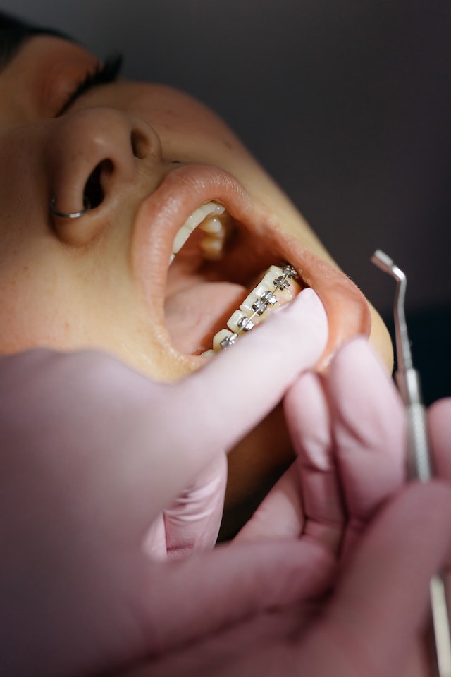 orthodontiste Praz