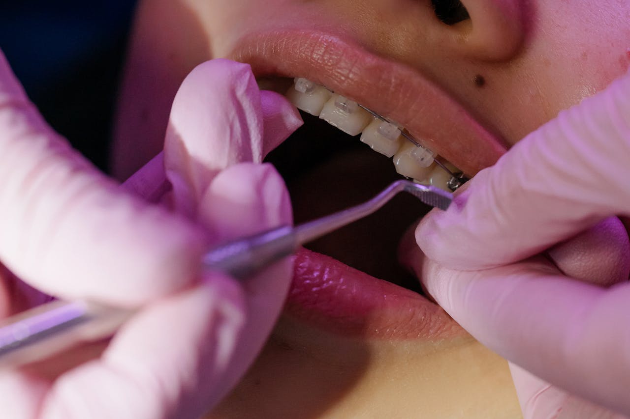 orthodontiste Saint-Aubin-Sauges