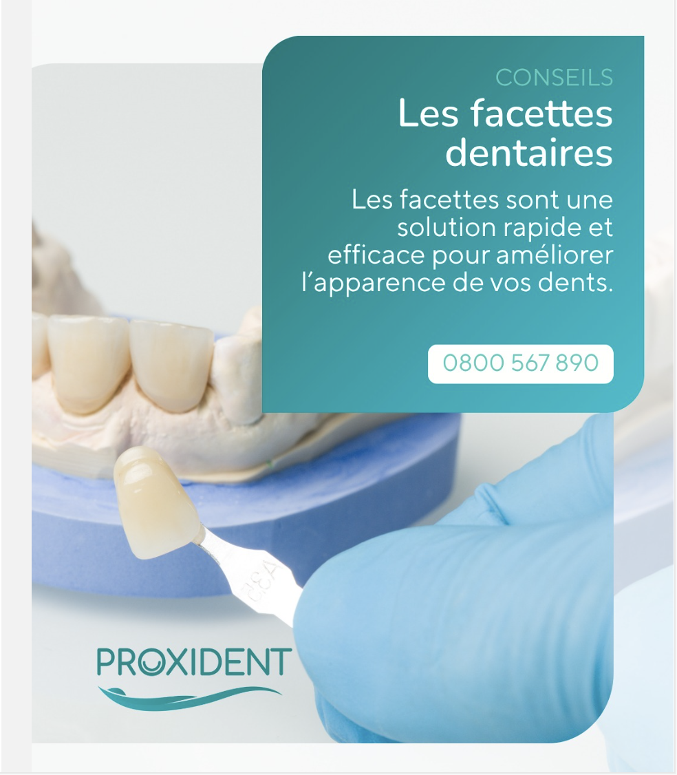 Facettes dentaires