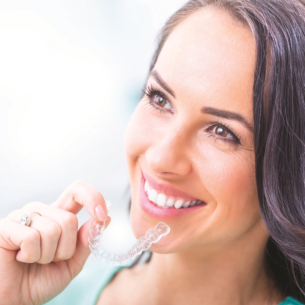 Aligner Invisalign
